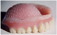Suction Cup Dentures