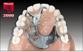 partial denture