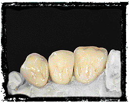 Crowns